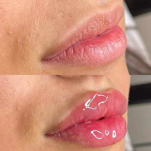 Luciu pentru volumul buzelor ⭐ 5/5 din 2.200+ recenzii 🔥 Cel mai vândut