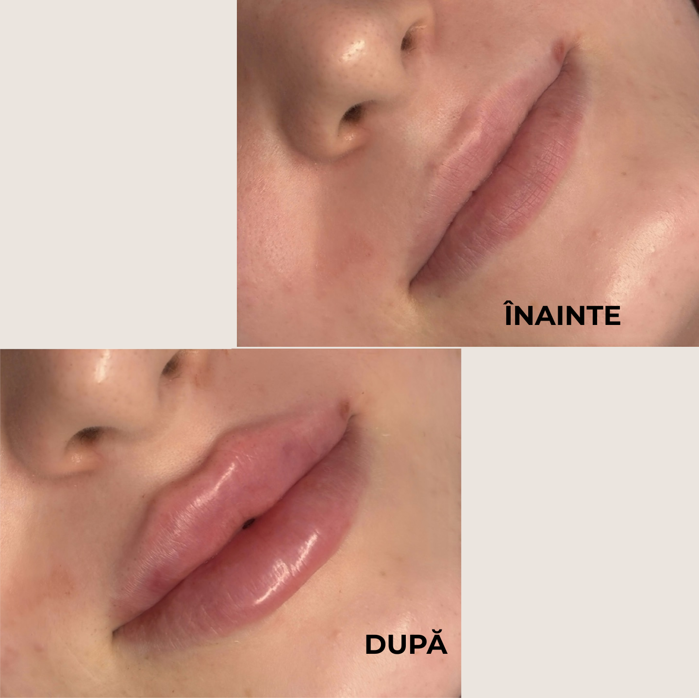 Luciu pentru volumul buzelor ⭐ 5/5 din 2.200+ recenzii 🔥 Cel mai vândut