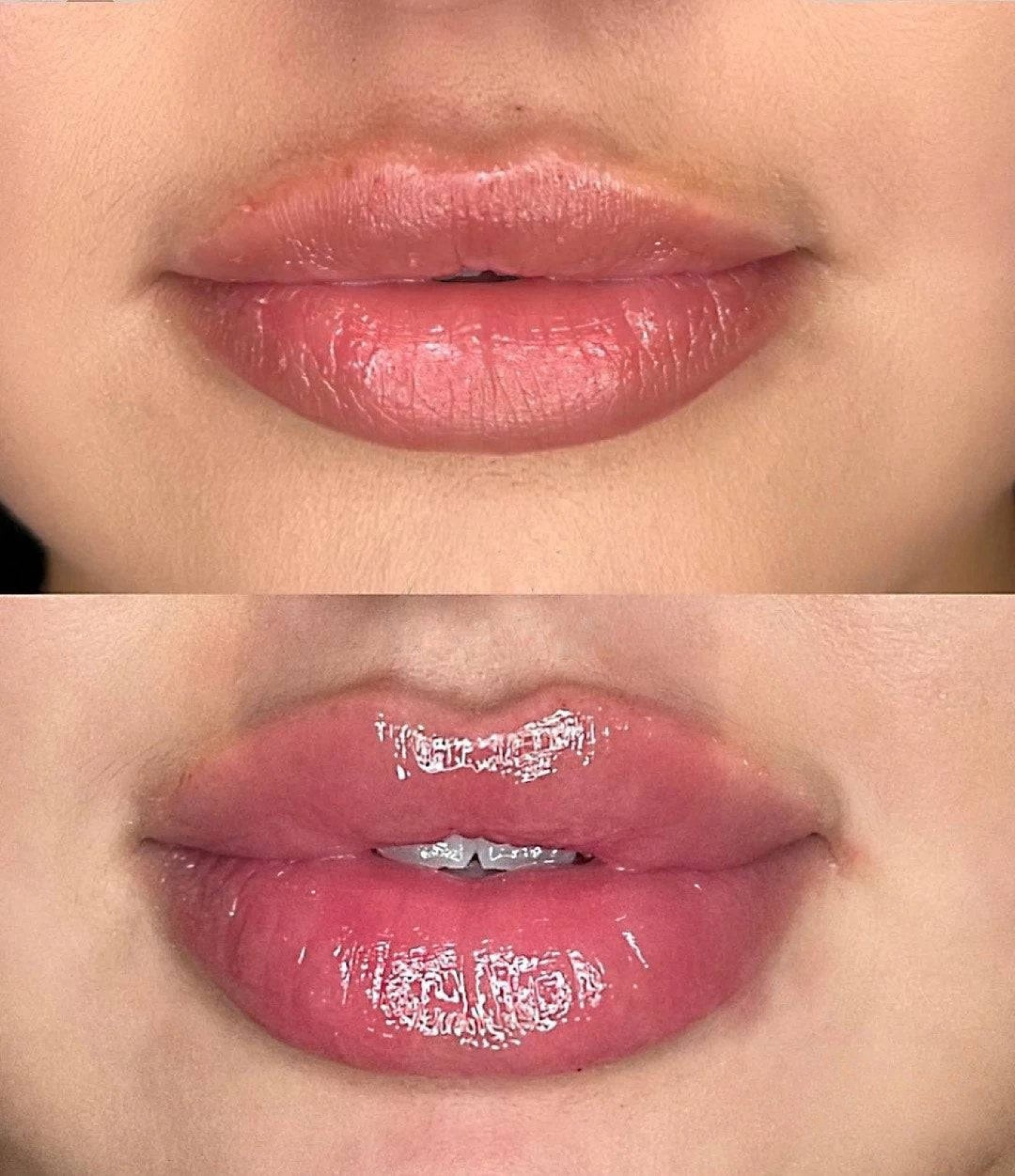 Luciu pentru volumul buzelor ⭐ 5/5 din 2.200+ recenzii 🔥 Cel mai vândut