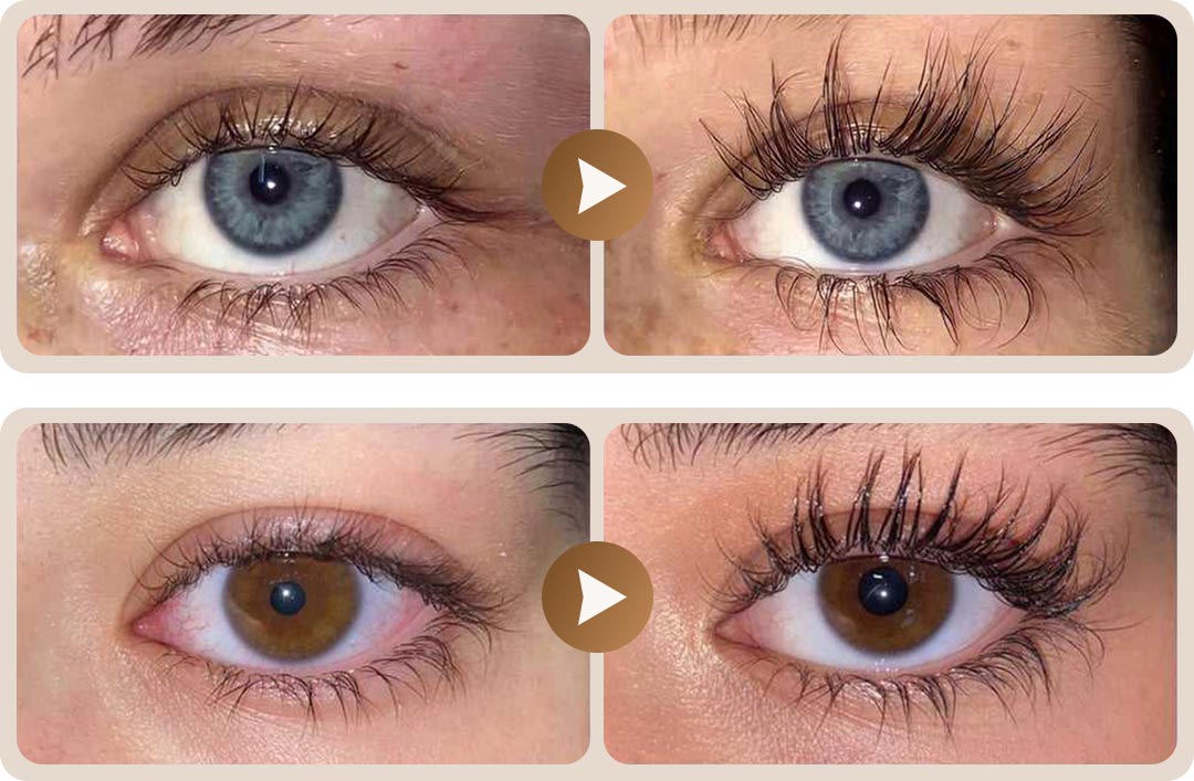 Ser intensiv pentru creșterea genelor ⭐ 4.8/5 din 1.200+ recenzii 🔥 Cel mai vândut