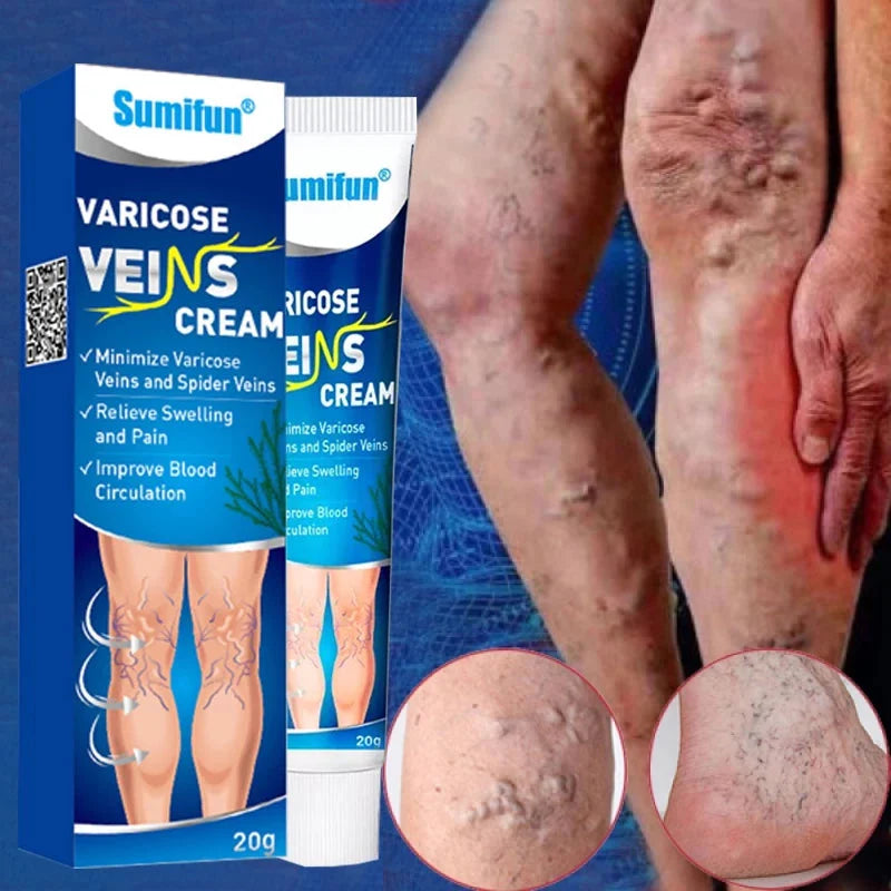Cremă pentru prevenirea varicelor 🔥Cel mai bine vândut