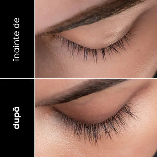 Ser intensiv pentru creșterea genelor ⭐ 4.8/5 din 1.200+ recenzii 🔥 Cel mai vândut